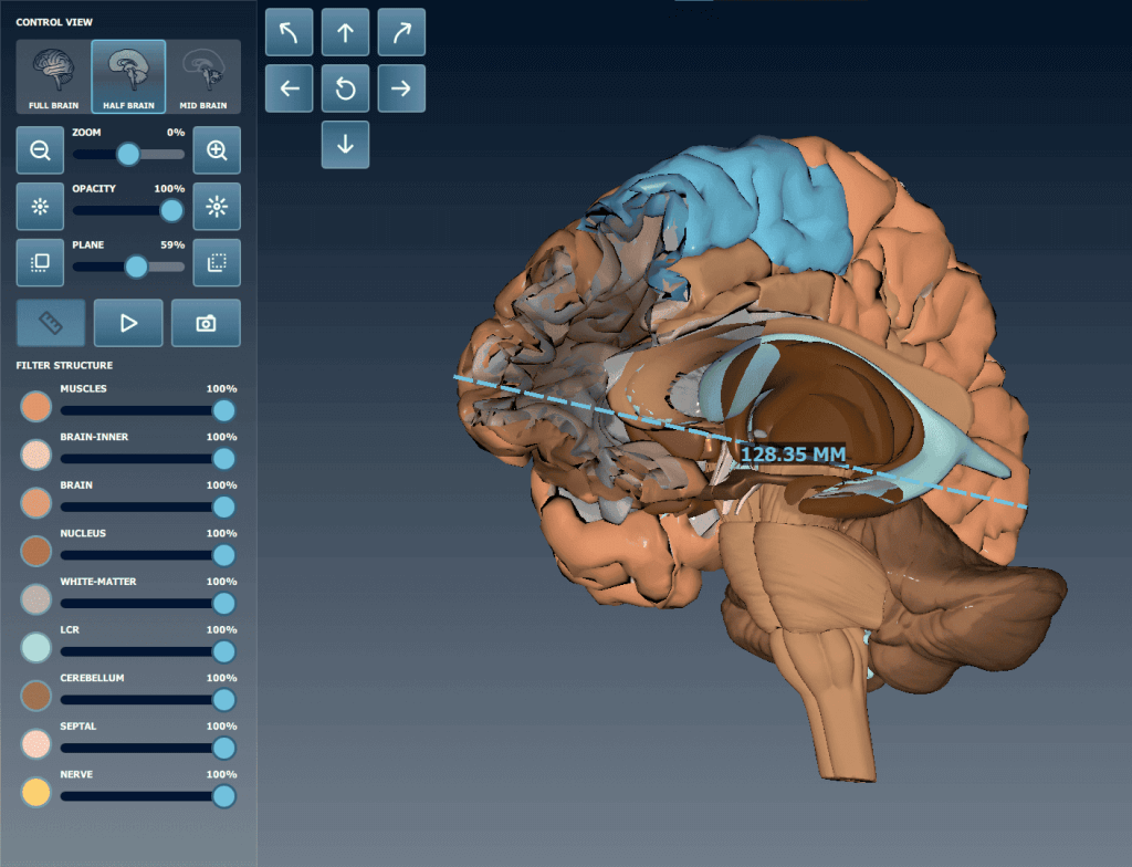 Cross-Platform Application for Previewing Parts of the Brain